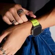 Skinarma óraszíj Shokku Apple Watch         49/45/44mm, sárga