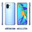 Wozinsky Anti Shock ütésálló tok Xiaomi Mi 11, átlátszó